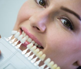 Dental Veneers Maintenance Tips for a Long-Lasting Smile
