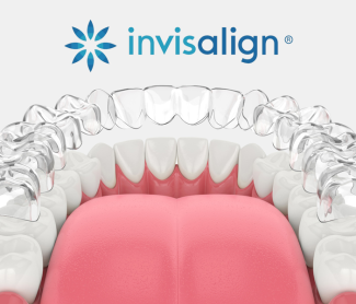 Why Invisalign from a Diamond Plus Provider in Brampton, Mississauga, Georgetown & Caledon Matters
