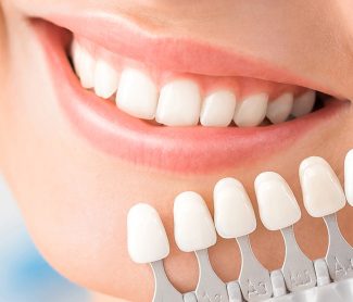 How Dental Veneers Help Create a Balanced, Even Smile